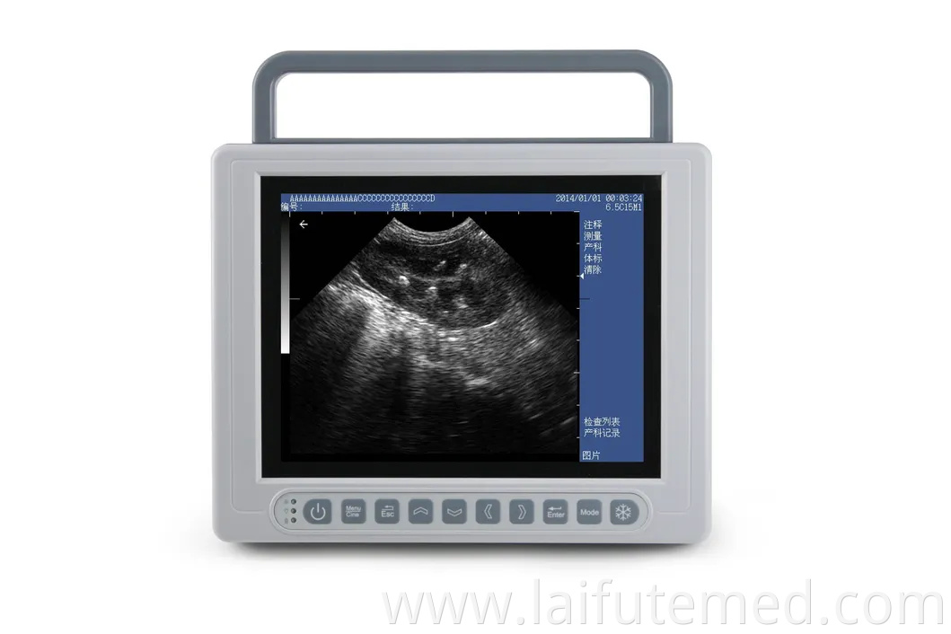 Portable Animal Veterinary Ultrasound for Medical Diagnostic Imaging Center Vet Using